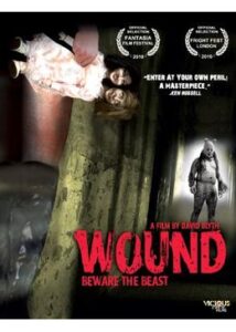 200409Wound76